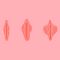 Educational diagram showing different normal variations of the vulva anatomy