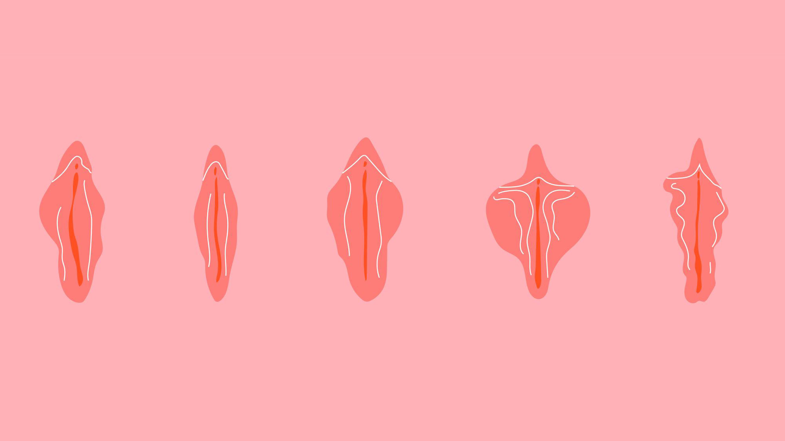 Diagrama educativo que muestra diferentes variaciones normales de la anatom&iacute;a de la vulva