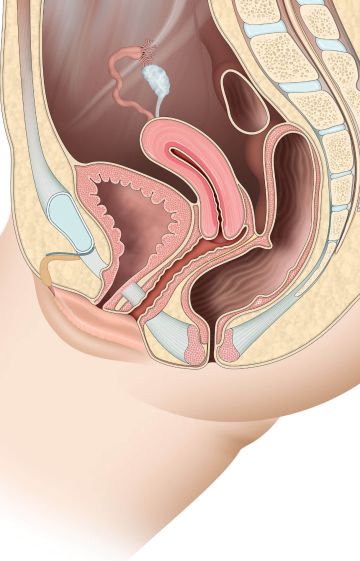 Diagram of the female reproductive system showing vulva, vagina, cervix, and clitoris