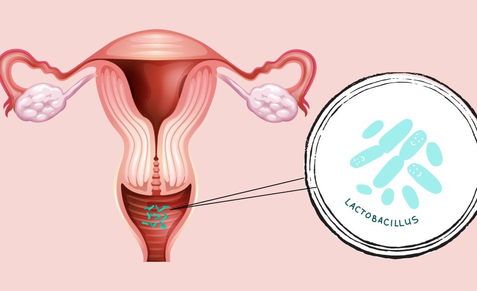 Illustration of the vaginal area showing a healthy pH balance and protective Lactobacilli bacteria.
