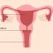 Illustration éducative de l’anatomie pelvienne féminine montrant utérus, ovaires, col de l’utérus, clitoris et muscles du plancher pelvien.